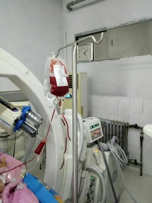 生死时速-产后大出血子宫动脉介入栓塞止血保子宫-永城市人民医院周围