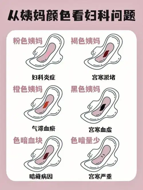 8715影响月经颜色的因素比较多,比如精神,环境,情绪,压力,受凉