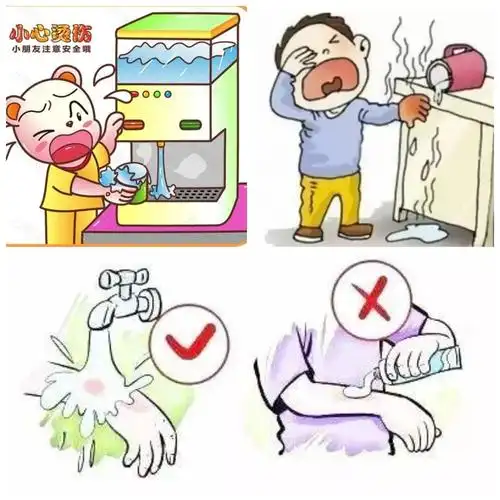 安全:《小心烫伤》