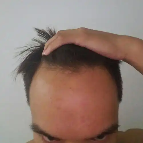 发际线高且m型发际线的男人适合什么发型?额头较大? - 知乎