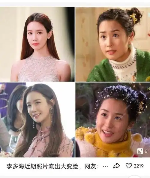 (李多海整容后遗症)