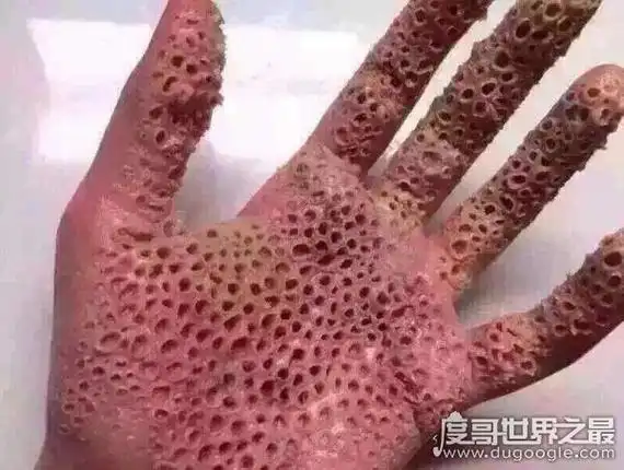 密集恐惧症测试图恶心,密集恐惧症大揭秘