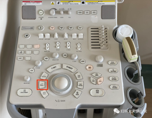 有的产科科室自己的机器操作预先设置可能找不到【presetd】按键,找找