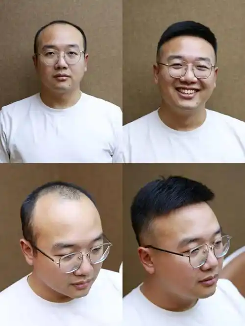 南宁一女子用30分钟将脱发老公改造成小鲜肉.