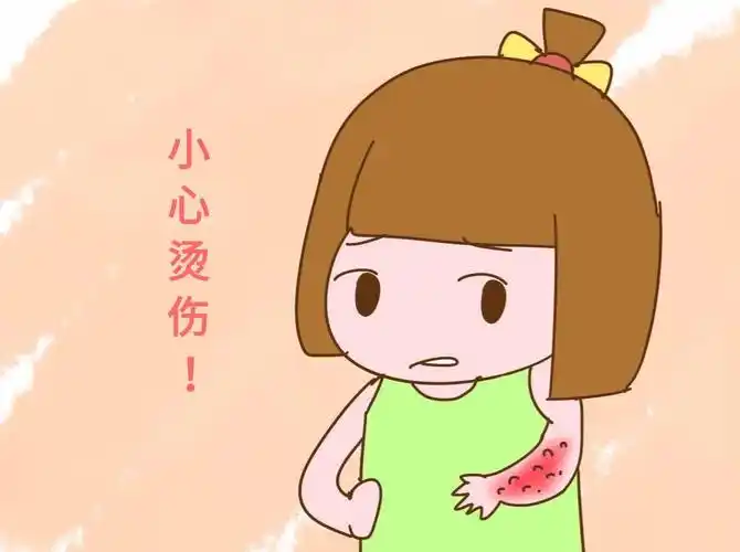 健康活动《小心烫伤》