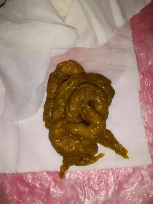 大便正常吗?【嫌恶心别进】