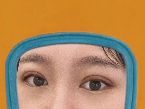 全切开扇双眼皮第九天我觉得这个形状是很适合我的