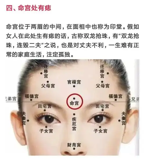 有集美额头上有二龙抢珠痣吗