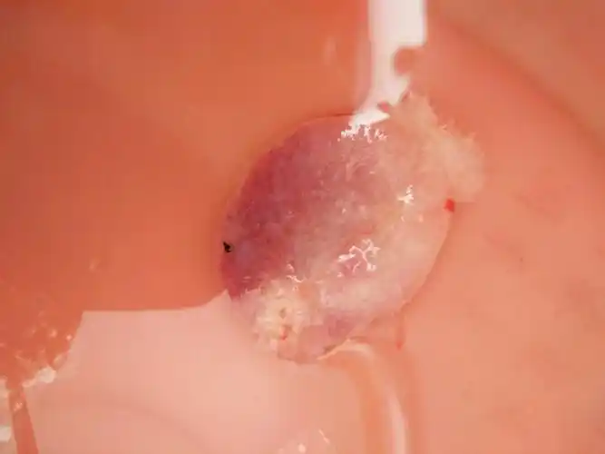 怀孕2个月做了药物流产第一天了,药物流产吃完药后多久能排出孕囊的呢