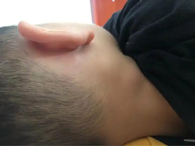 请问各位两岁孩子脖子淋巴结发炎怎么回事