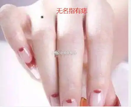 看看你中了吗?无名指长痣的人容易出现不期而遇的桃花.