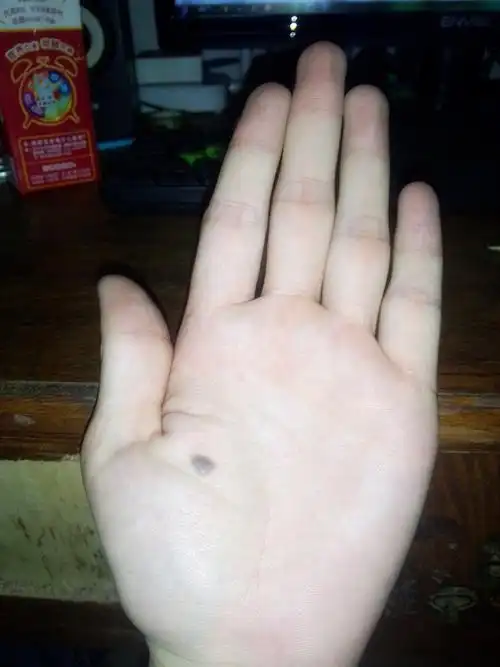 女生左手掌有痣代表什么(女生左手掌有痣代表什么意思图解)