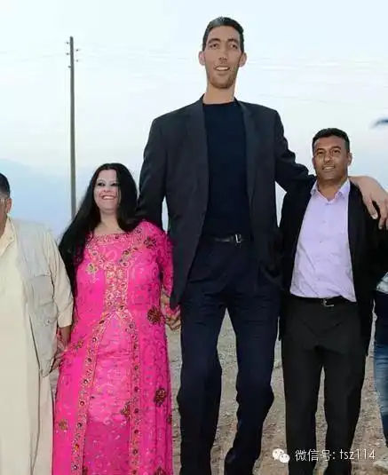 世界巨人身高2米85