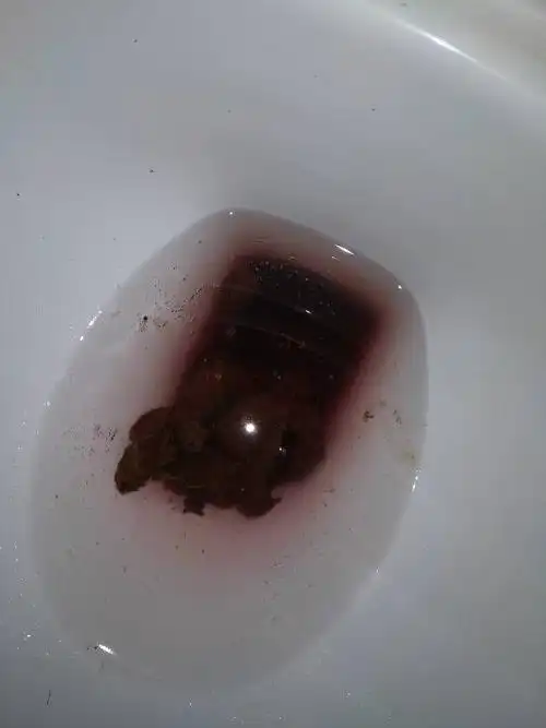 昨天午饭吃了猪血,,到今早却排出了黑便便而且有点点猪血的颜色如图