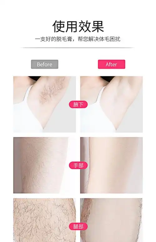 玛贝拉脱毛膏腋下男女士腿毛私处全身去除汗毛脱毛神器非永久专用