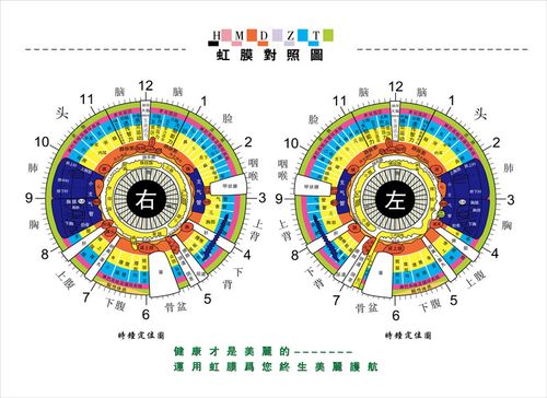 752海报印制展板写真喷绘688医疗知识看眼知健康虹膜检查对照图