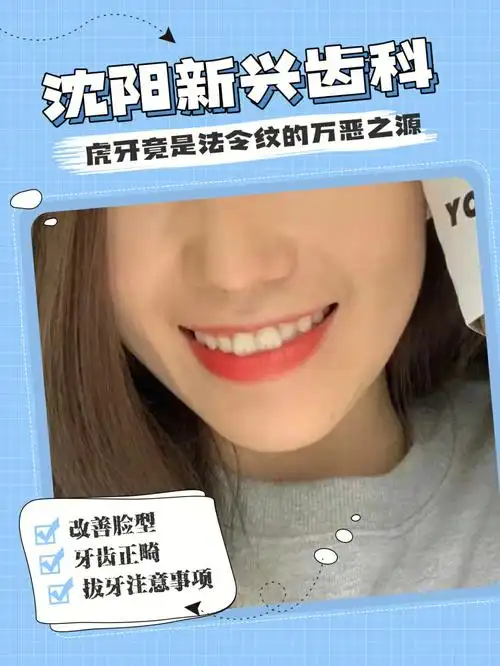 新兴齿科小知识可爱的虎牙有必要矫正吗