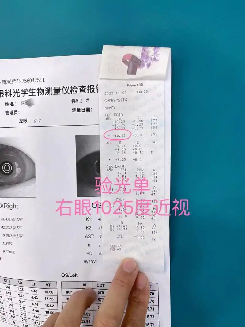 眼轴基本正常,为什么验光单近视1000度?