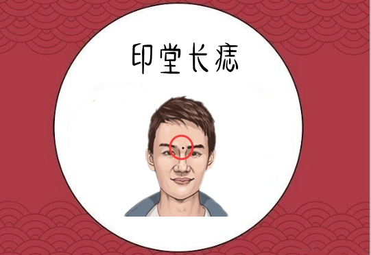 男人脸上4颗"小人"痣,心肠狠,城府深,为钱六亲不认!