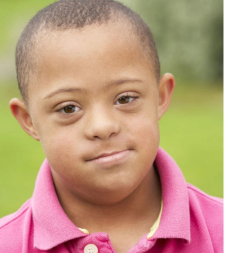 什么是唐氏综合症,能治疗得好吗?