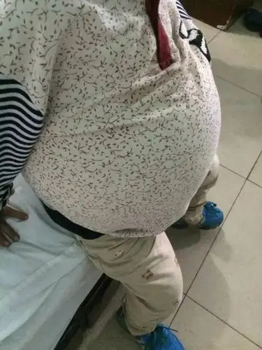 六岁"大肚男孩"牵动百万南宁人的心,5月26日晚将进行爱心募捐