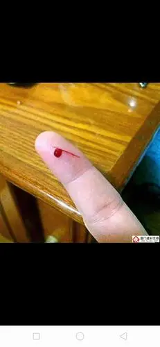 常乐中心幼儿园小二班—《手划破了》安全教育主题活动