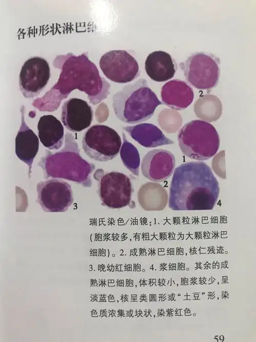 各种淋巴细胞及其它细胞