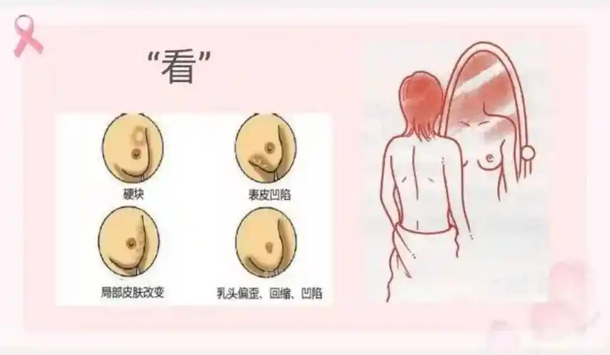 好消息!我院甲乳外科新增诊室啦!_诊治_乳房_疾病