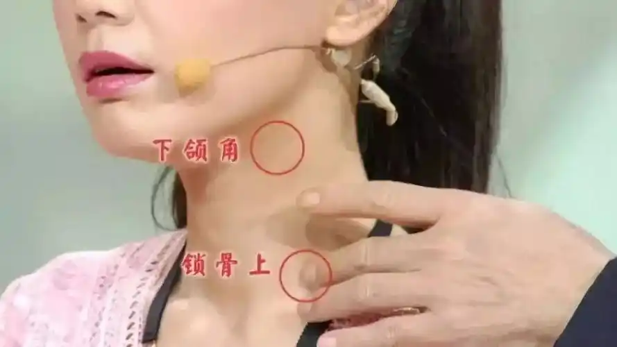 淋巴系统是由淋巴结,淋巴管,淋巴液以及一些非淋巴结的器官或组织共同