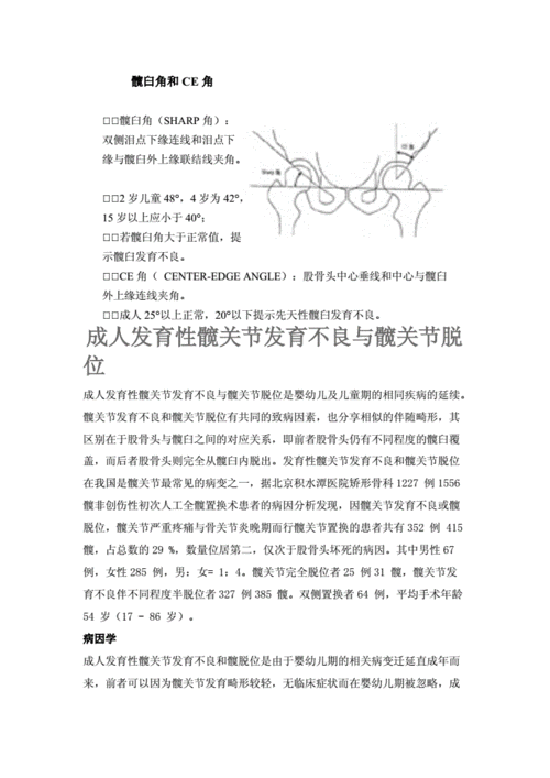 髋臼角和ce角doc