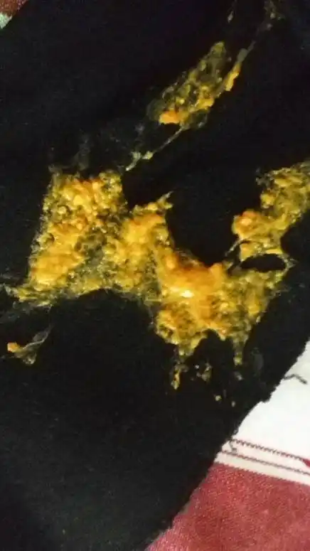 宝宝之前拉的便便是这样的只看楼主