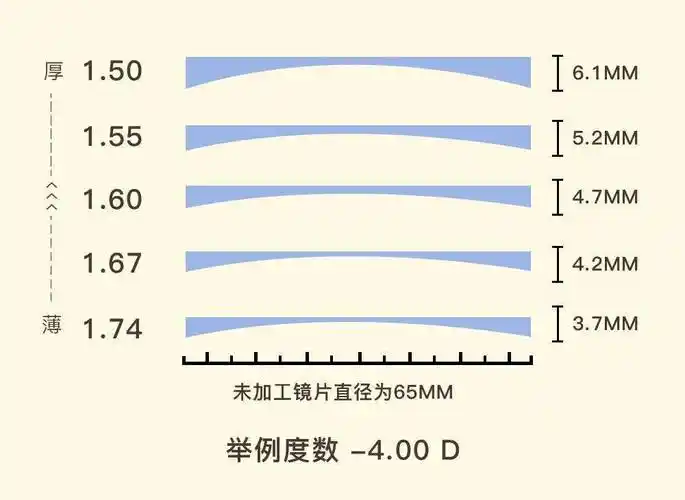 高度近视的患者如何让镜片显瘦