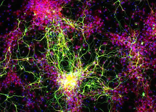 新的研究模型可能导致视力丧失治疗_出国看病复诊网
