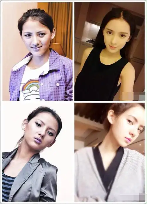 张予曦整容照疑曝光