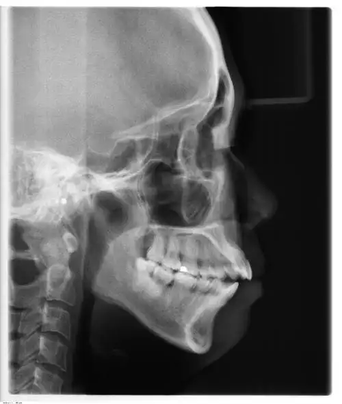 美我们更关注侧脸