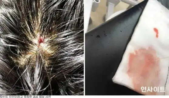 韩男团成员自曝遭队友暴打 头部出血脸上伤痕累累