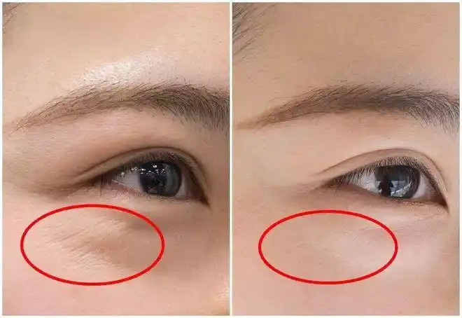 法令纹抬头纹鱼尾纹看了女星素颜才知女人的差距这么大