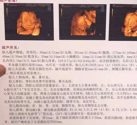 产检时,b超单上出现这5个字,就偷乐吧,可能是"小皇子"驾到!