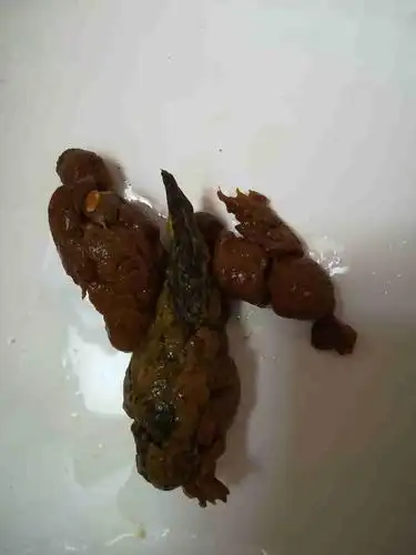 大便这种颜色正常吗?