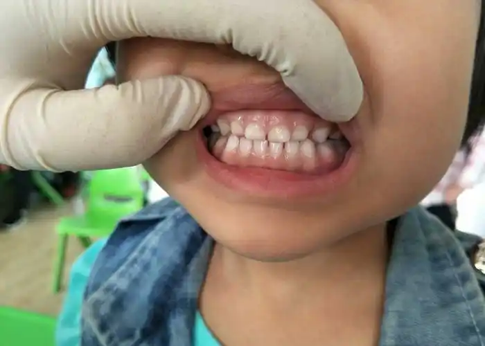 大班健康教育系列活动————《我的牙齿更健康》