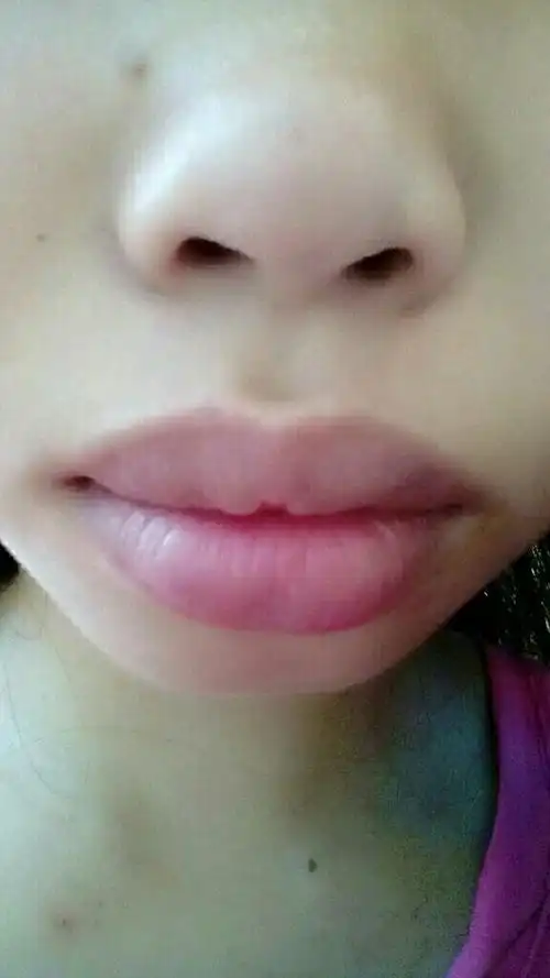 我的嘴唇要怎样变薄,不喜匆喷