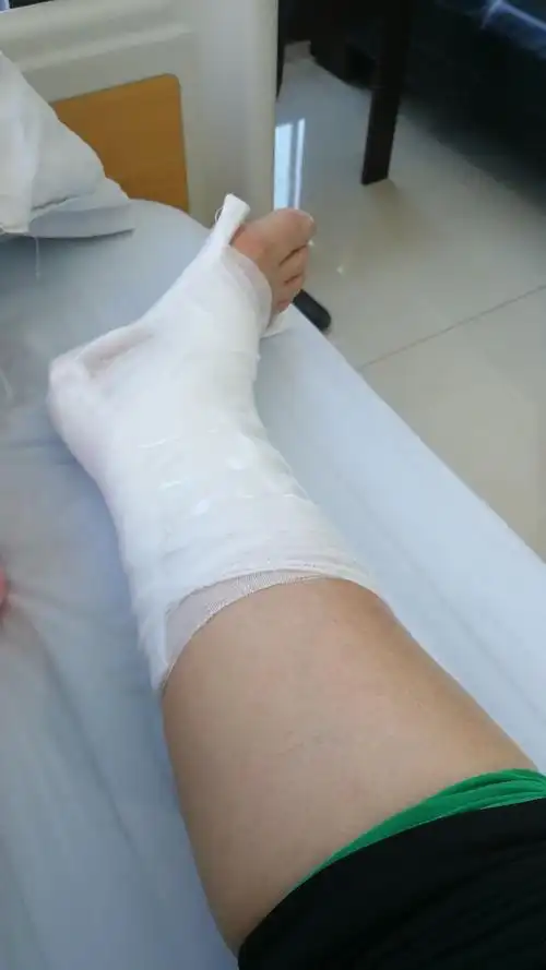 简单的包扎,石膏固定