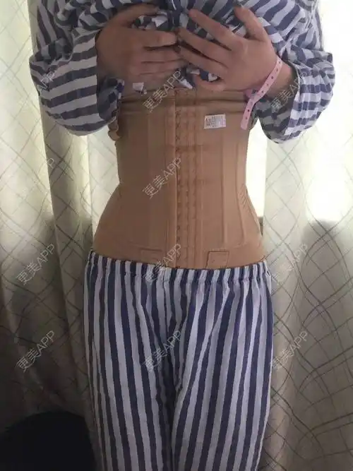 更美用户o621szuvsg的腰部吸脂日记