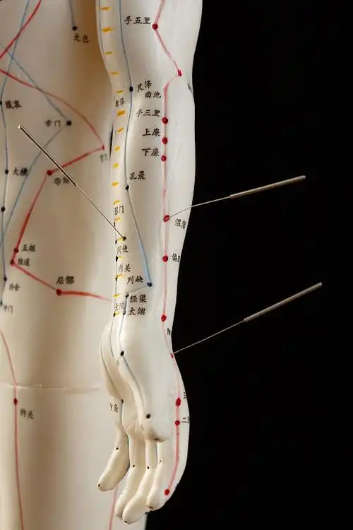针灸穴位图片素材