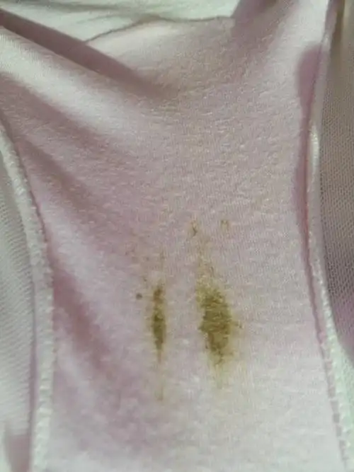 怀孕七周了,内裤上有这种分泌物正常吗?