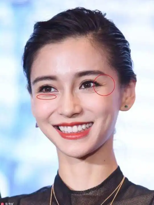 弹弹弹,弹不走的鱼尾纹怎么办?眼霜,胶原蛋白究竟该用什么