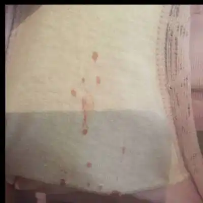 这两天内裤上都有血,但是擦下面也没有,宝妈们这是怎麼回事?是见红吗?