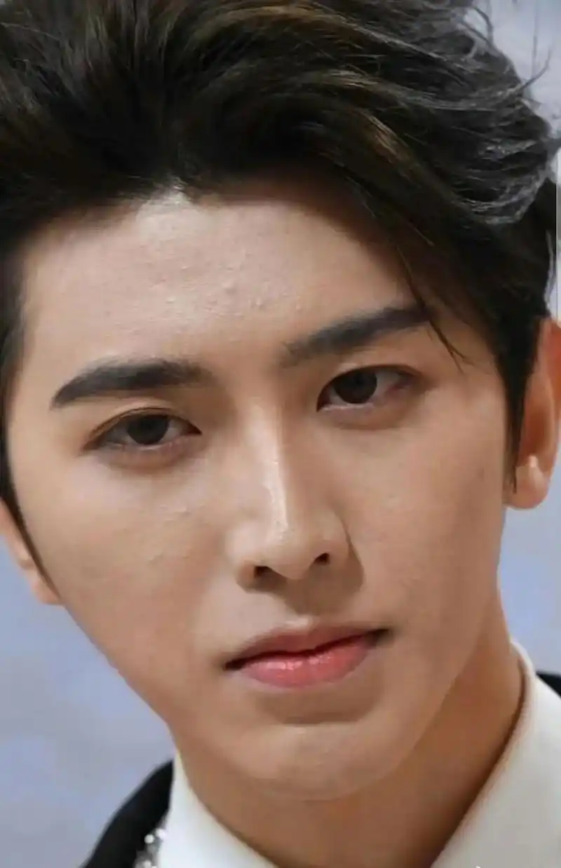 蔡徐坤怼脸生图,明星花大价钱保养脸都有痘痘闭口,普通人也不要纠结