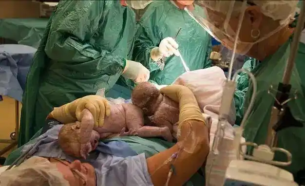 让你瞬间看懂顺产分娩全过程到底是怎样的_网易订阅