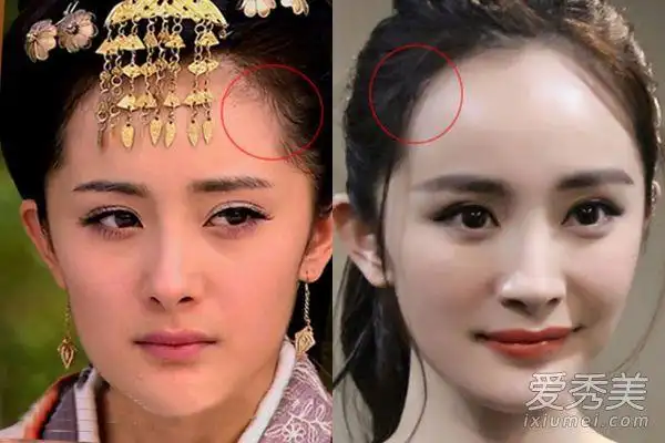 杨幂整容前后照片